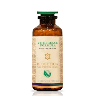 Vitiligease Formula