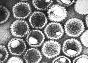Herpes Management: Understanding Treatment Options