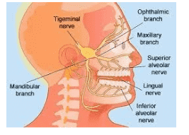 Can Trigeminal Neuralgia Be Cured Naturally