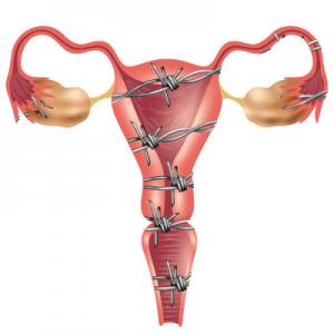 Natural Therapies for Menopausal Symptoms