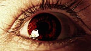 Eye Cataract Causes: Decoding the Mystery