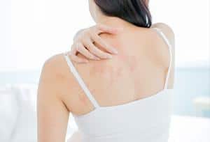 Easing Eczema Itch: Natural Remedies and Care Tips
