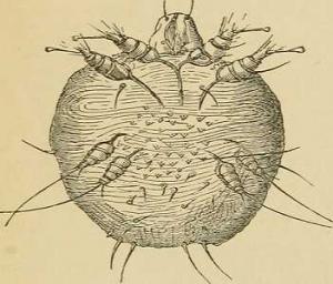 Scabies Management in Homeopathy